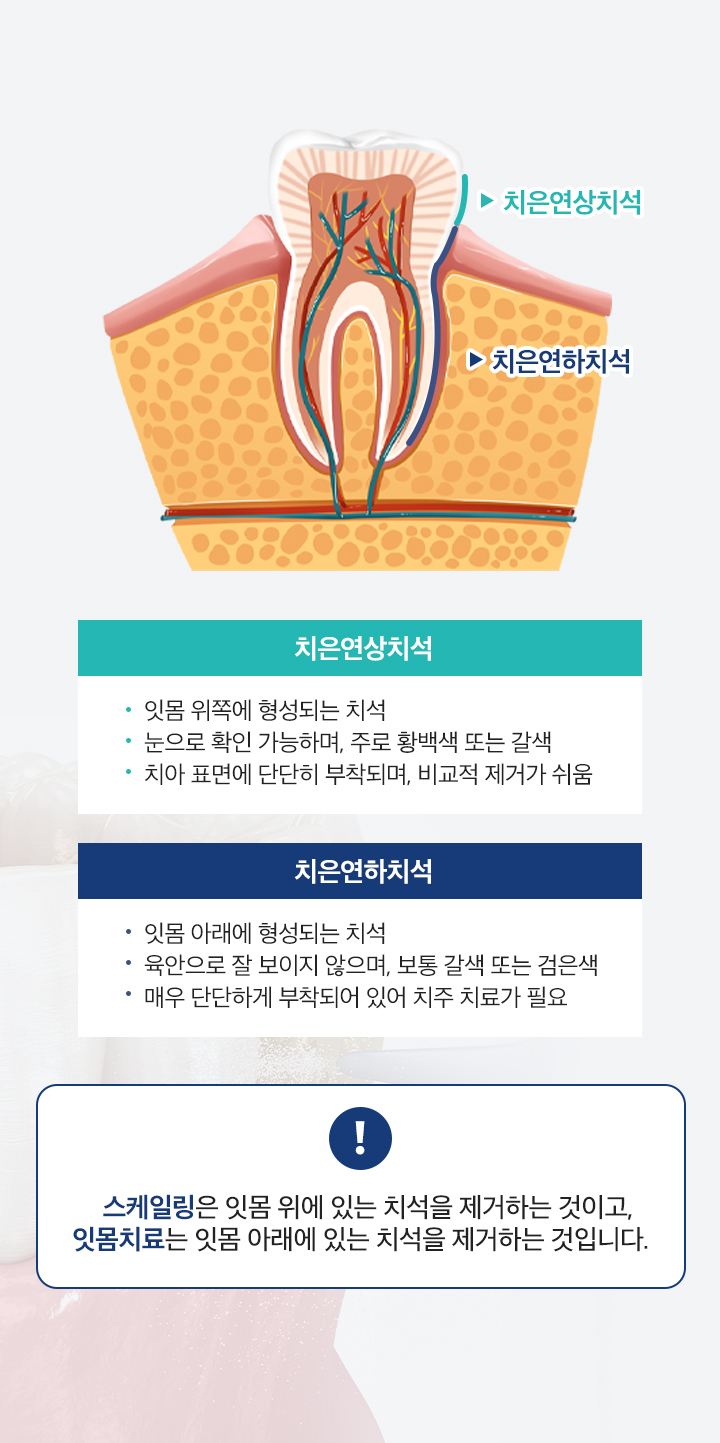 스케일링