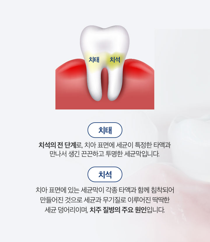잇몸치료