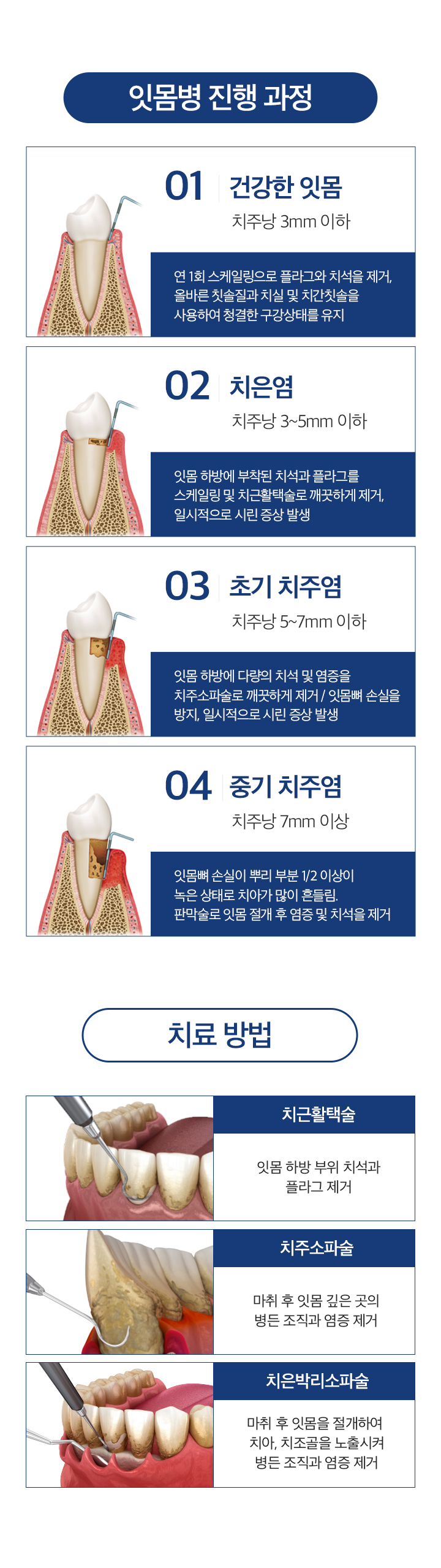 잇몸치료