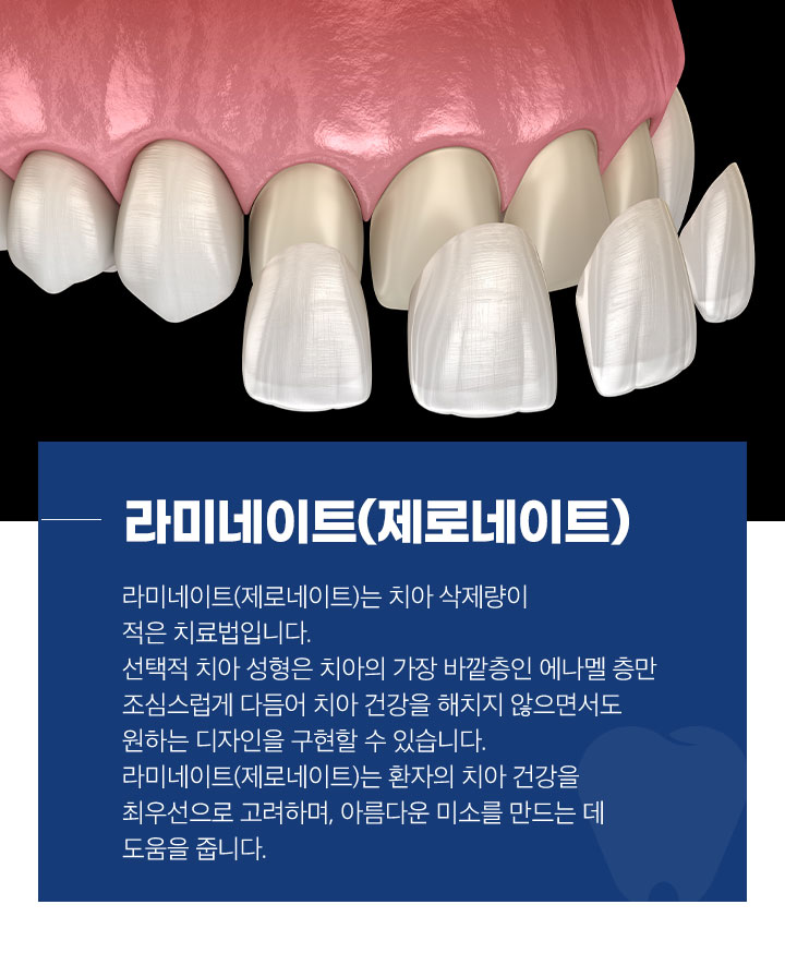 라미네이트