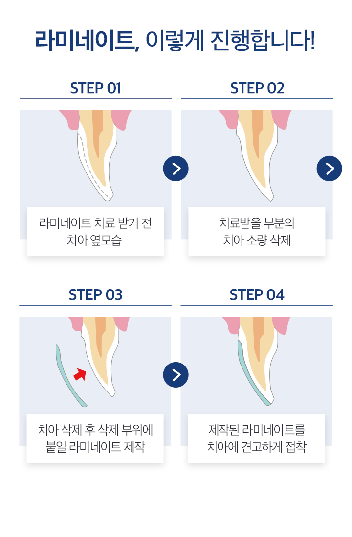 라미네이트
