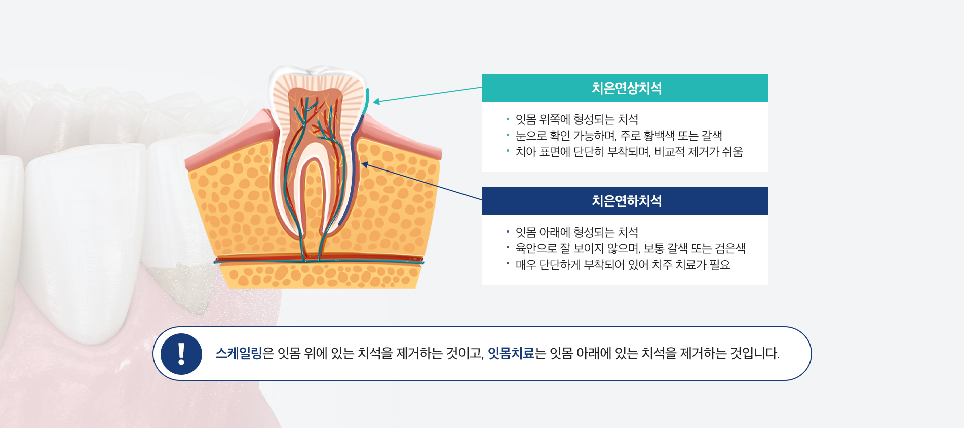 스케일링