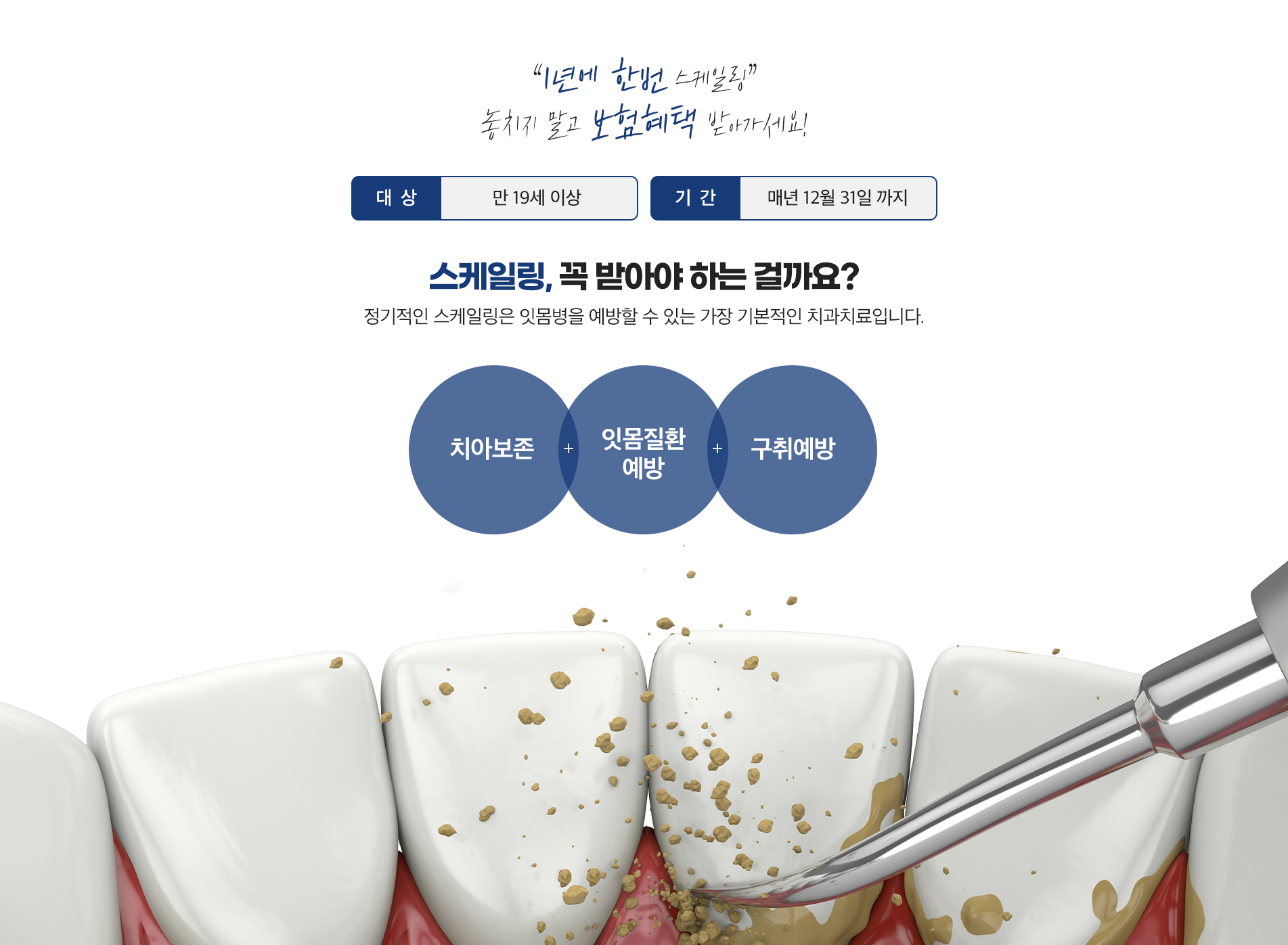 스케일링