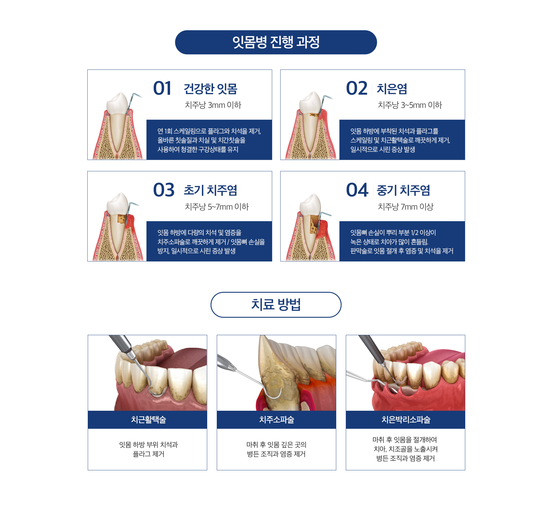 잇몸치료