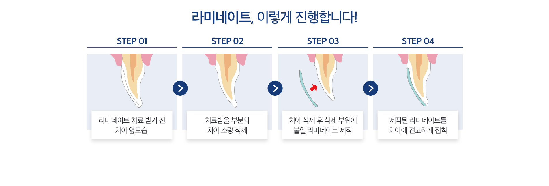 라미네이트