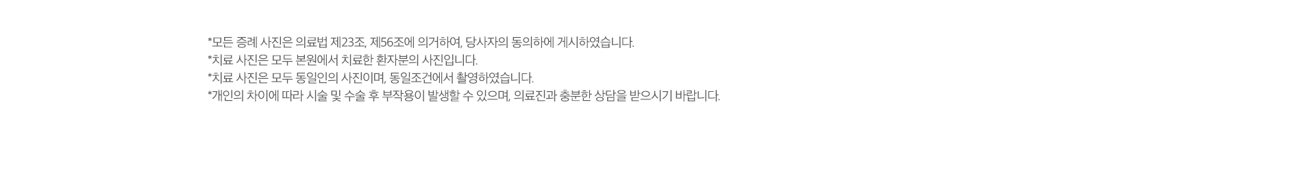 치료전후사진 업로드 주의사항