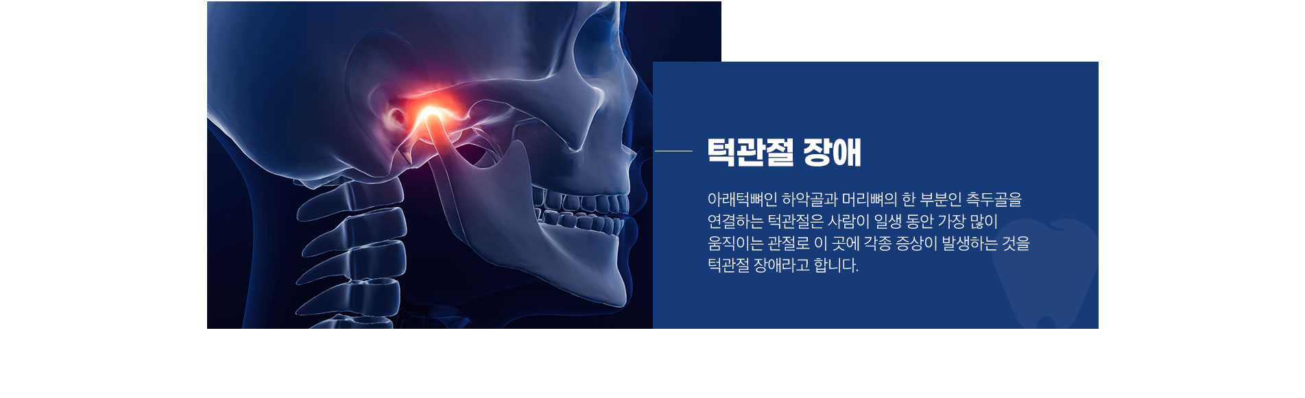 턱관절 장애