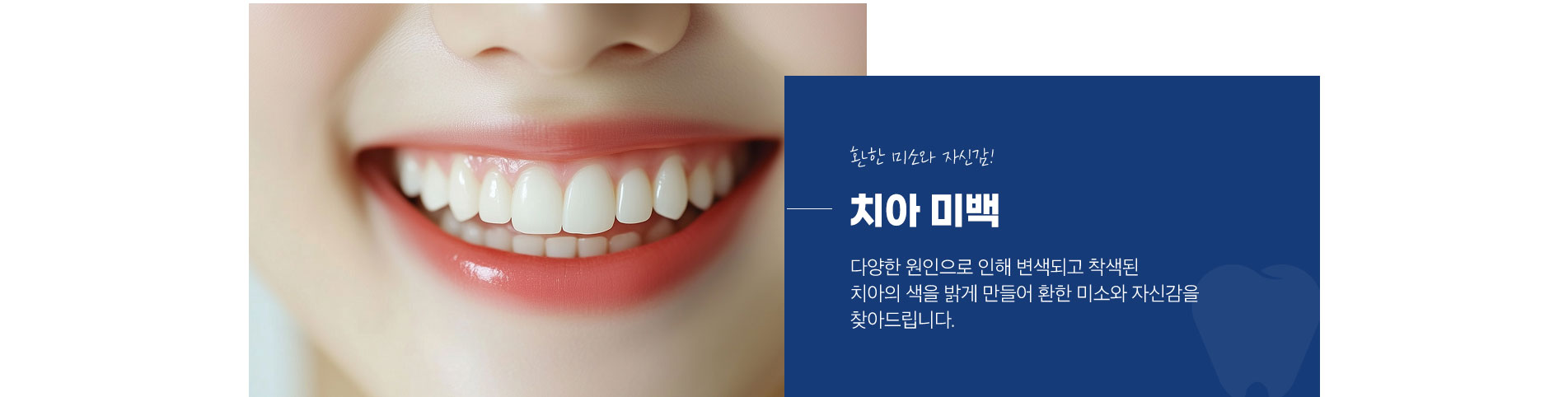 치아 미백